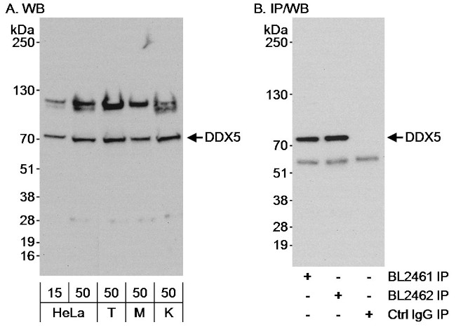 DDX5 Antibody in Western Blot (WB)