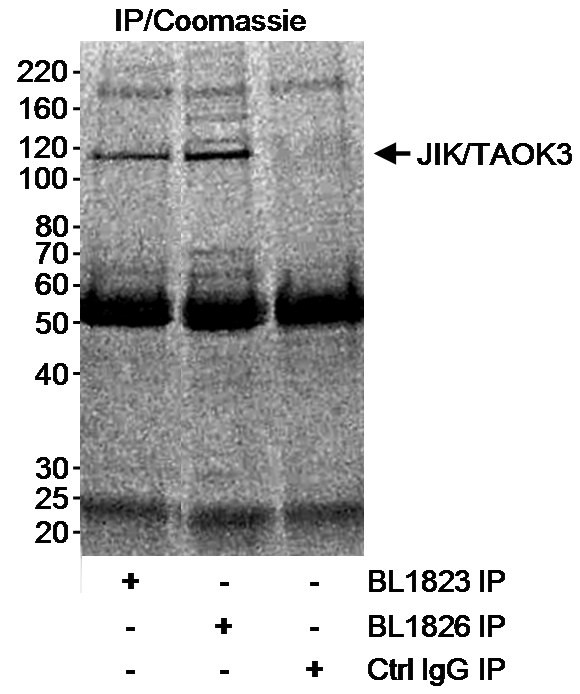 JIK/TAOK3 Antibody in Immunoprecipitation (IP)