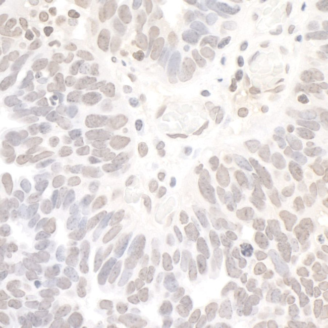 REST Antibody in Immunohistochemistry (Paraffin) (IHC (P))