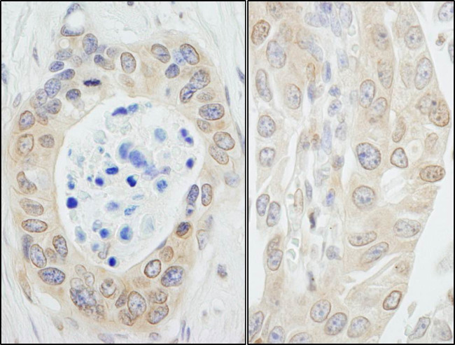 NMI Antibody in Immunohistochemistry (Paraffin) (IHC (P))