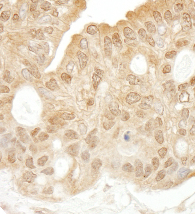 SYK Antibody in Immunohistochemistry (Paraffin) (IHC (P))