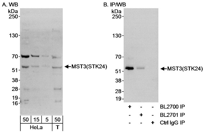 MST3/STK24 Antibody in Western Blot (WB)