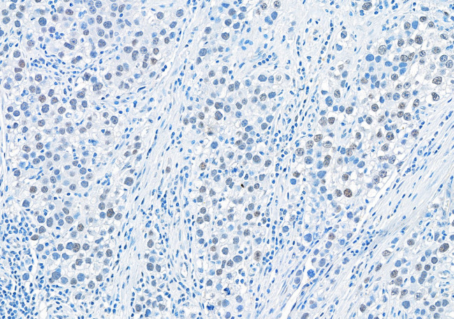 RIF1 Antibody in Immunohistochemistry (Paraffin) (IHC (P))