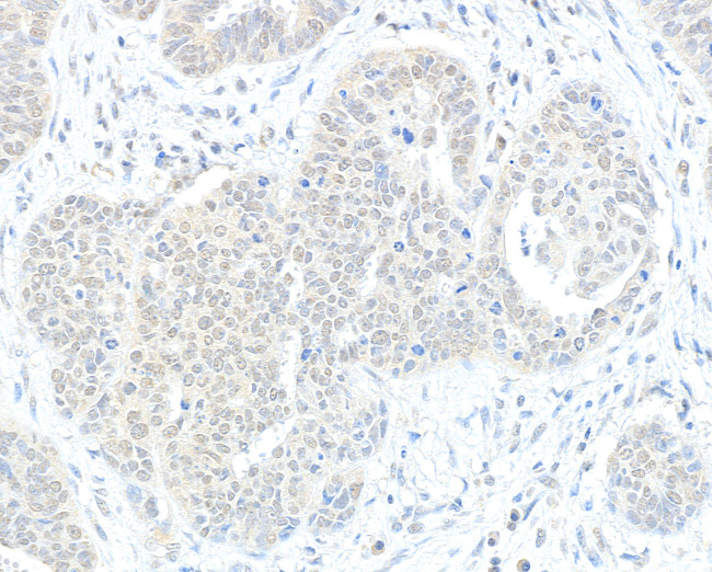 RIF1 Antibody in Immunohistochemistry (Paraffin) (IHC (P))