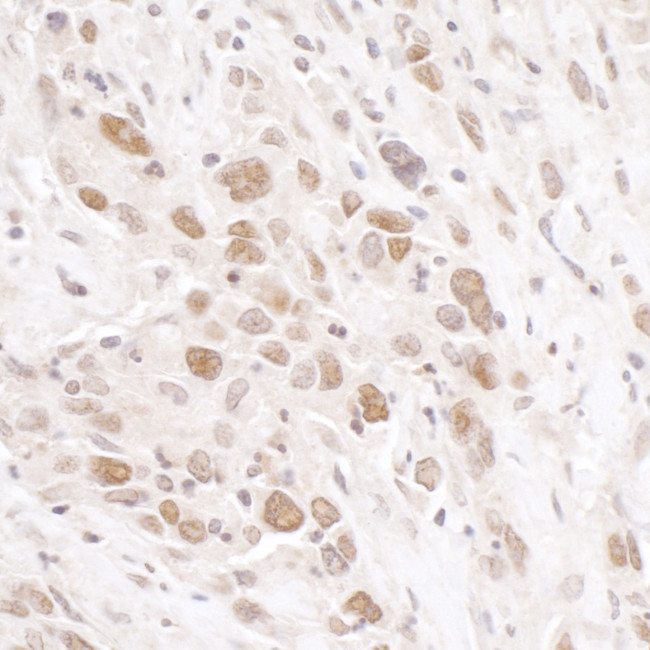 RIF1 Antibody in Immunohistochemistry (Paraffin) (IHC (P))