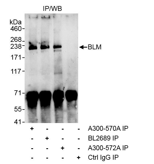 BLM Antibody in Immunoprecipitation (IP)