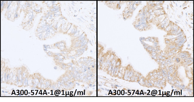 INPPL1/SHIP2 Antibody in Immunohistochemistry (Paraffin) (IHC (P))