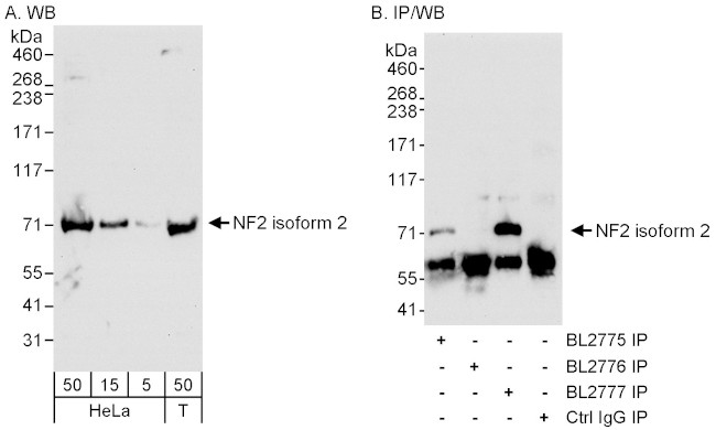 NF2 Antibody in Western Blot (WB)