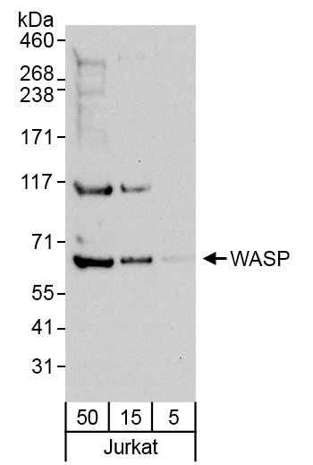 WASP Antibody in Western Blot (WB)