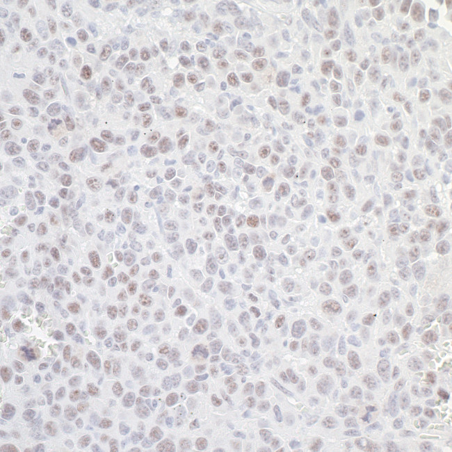 GNL3 Antibody in Immunohistochemistry (Paraffin) (IHC (P))