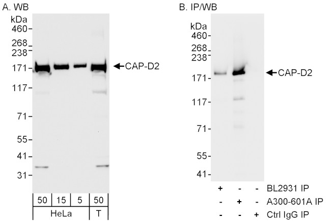 CAP-D2 Antibody in Western Blot (WB)