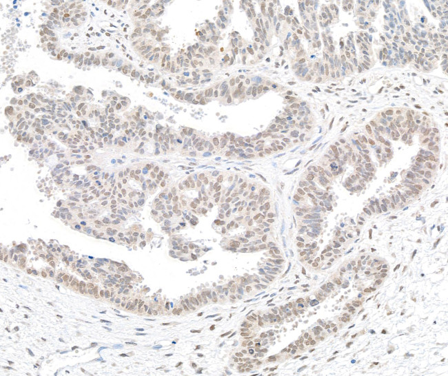 BTF Antibody in Immunohistochemistry (Paraffin) (IHC (P))