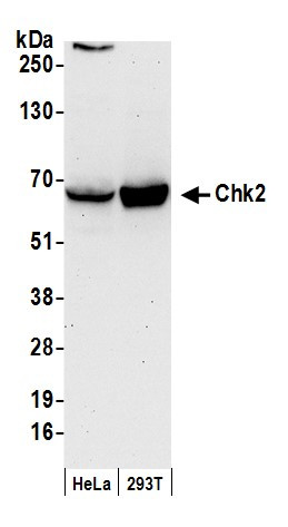 Chk2 Antibody in Western Blot (WB)