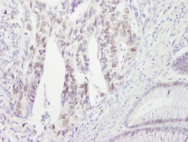 Chk2 Antibody in Immunohistochemistry (Paraffin) (IHC (P))