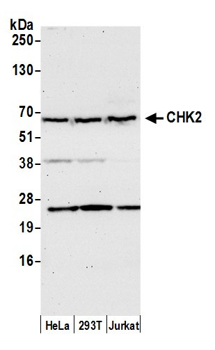 Chk2 Antibody in Western Blot (WB)