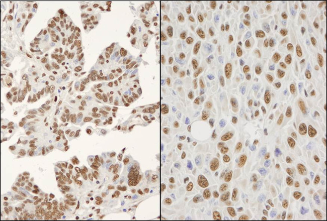 hnRNP-K Antibody in Immunohistochemistry (Paraffin) (IHC (P))