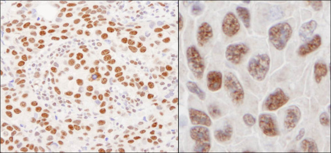 hnRNP-U Antibody in Immunohistochemistry (Paraffin) (IHC (P))