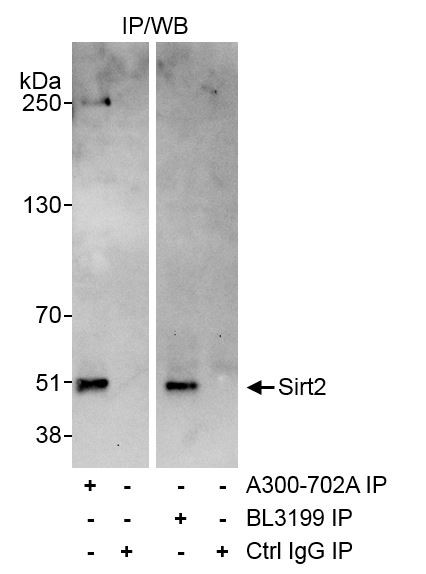 Sirt2 Antibody in Immunoprecipitation (IP)