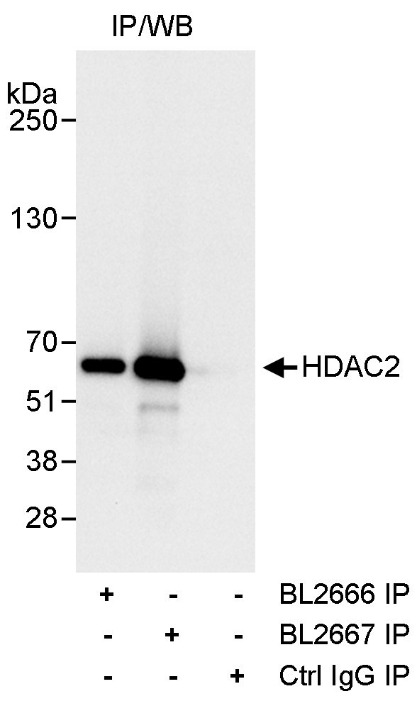 HDAC2 Antibody in Immunoprecipitation (IP)