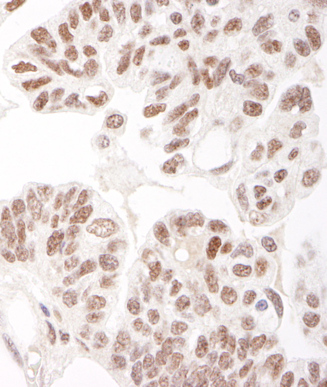 HDAC2 Antibody in Immunohistochemistry (Paraffin) (IHC (P))