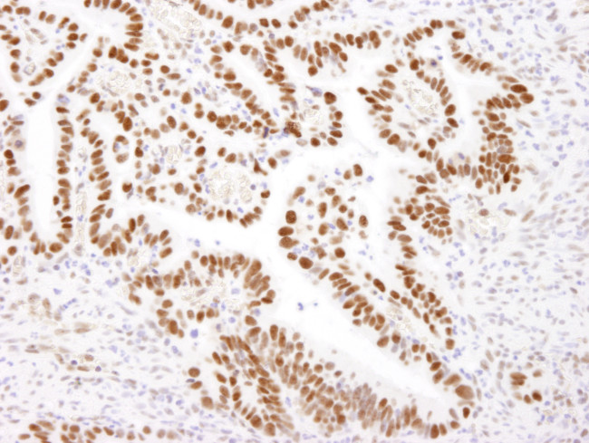 Nucleolin/NCL Antibody in Immunohistochemistry (Paraffin) (IHC (P))