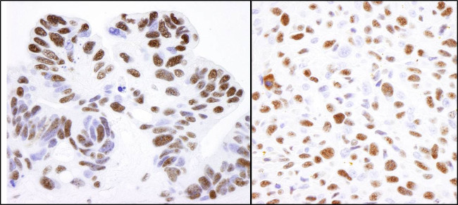 Nucleolin/NCL Antibody in Immunohistochemistry (Paraffin) (IHC (P))