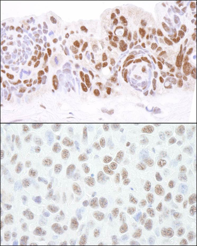 HDAC1 Antibody in Immunohistochemistry (Paraffin) (IHC (P))