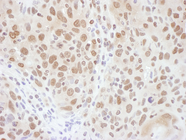 RNF20 Antibody in Immunohistochemistry (Paraffin) (IHC (P))