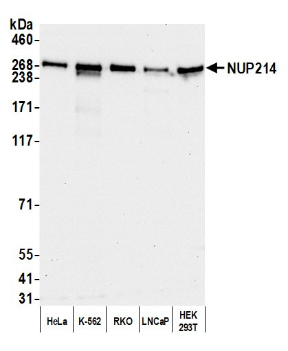 NUP214 Antibody in Western Blot (WB)