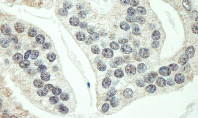 RNF40 Antibody in Immunohistochemistry (Paraffin) (IHC (P))