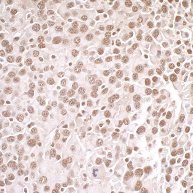 PRMT1 Antibody in Immunohistochemistry (Paraffin) (IHC (P))