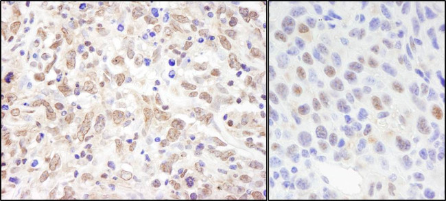 Sin3A Antibody in Immunohistochemistry (Paraffin) (IHC (P))