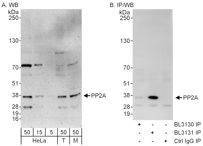 PP2A Antibody in Western Blot (WB)