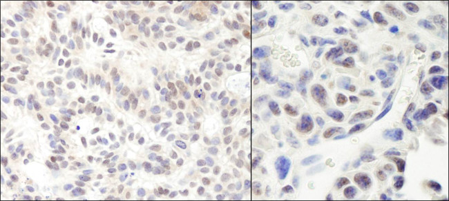 HMG2a Antibody in Immunohistochemistry (Paraffin) (IHC (P))