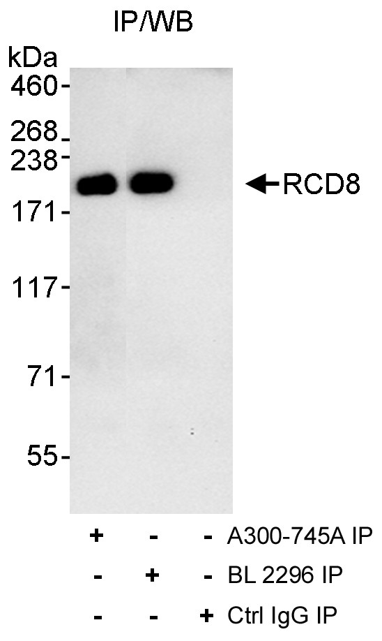 RCD8 Antibody in Immunoprecipitation (IP)