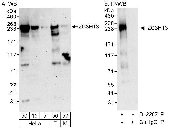 ZC3H13 Antibody in Western Blot (WB)