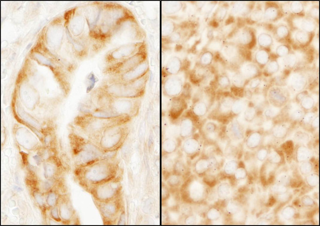 rpL7a/SURF3 Antibody in Immunohistochemistry (Paraffin) (IHC (P))