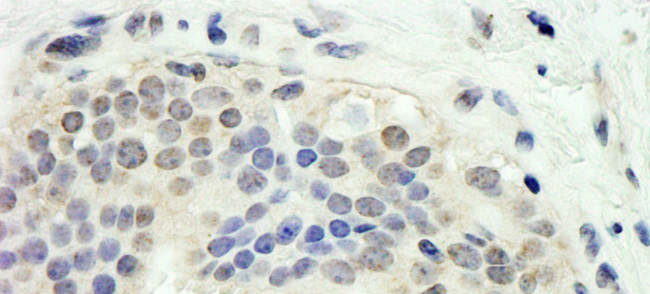 E2F1 Antibody in Immunohistochemistry (Paraffin) (IHC (P))