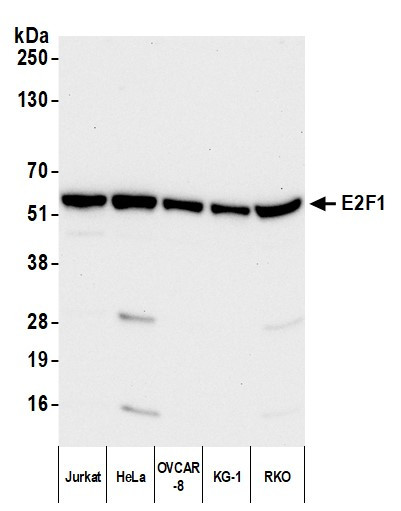 E2F1 Antibody in Western Blot (WB)