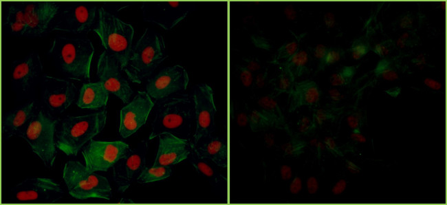 Phospho-KAP-1 (Ser824) Antibody in Immunocytochemistry (ICC/IF)