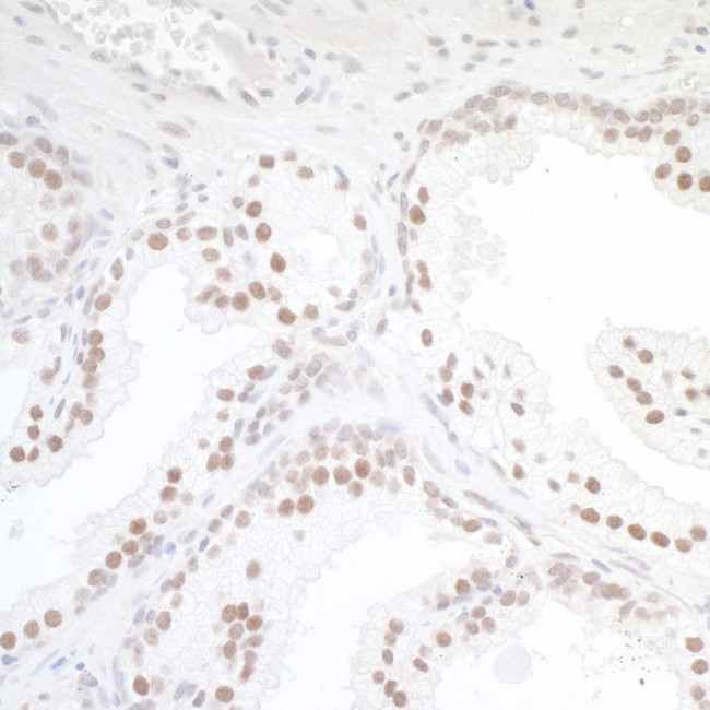 TORC1 Antibody in Immunohistochemistry (Paraffin) (IHC (P))