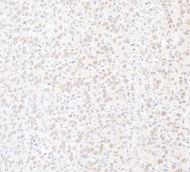 MED12 Antibody in Immunohistochemistry (Paraffin) (IHC (P))