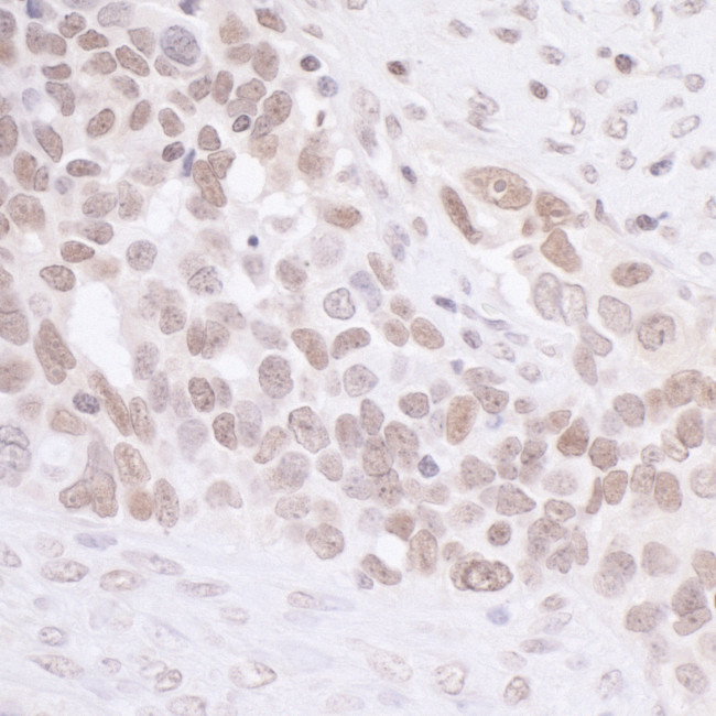 MIS12 Antibody in Immunohistochemistry (Paraffin) (IHC (P))