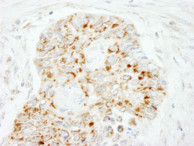 MAVS/VISA Antibody in Immunohistochemistry (Paraffin) (IHC (P))