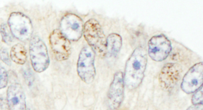 NCOA62 Antibody in Immunohistochemistry (Paraffin) (IHC (P))