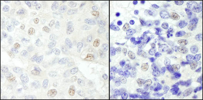 NCOA62 Antibody in Immunohistochemistry (Paraffin) (IHC (P))