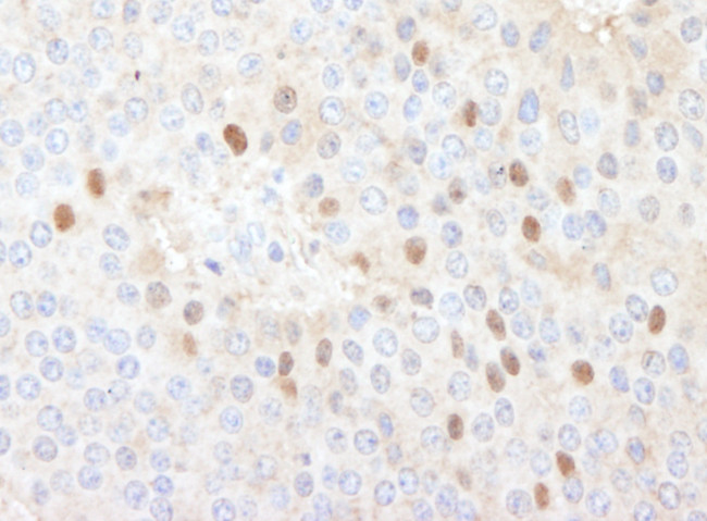 CDT1 Antibody in Immunohistochemistry (Paraffin) (IHC (P))