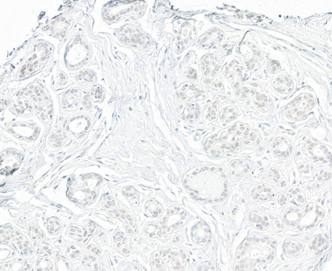 TRIP1/SUG1 Antibody in Immunohistochemistry (Paraffin) (IHC (P))