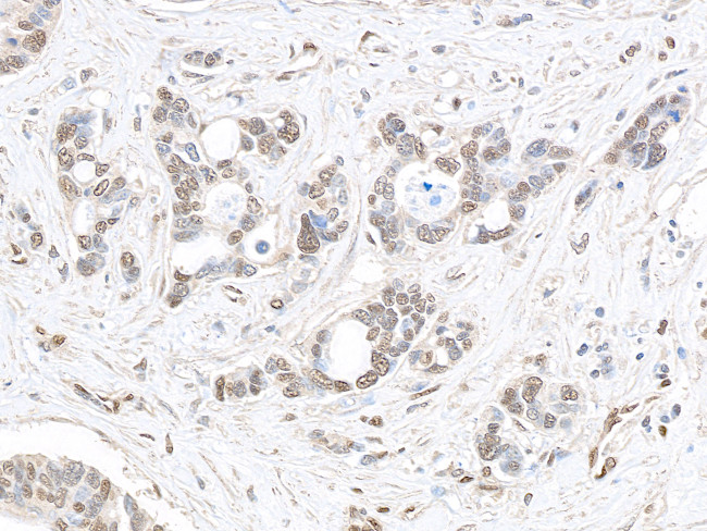 MED1 Antibody in Immunohistochemistry (Paraffin) (IHC (P))