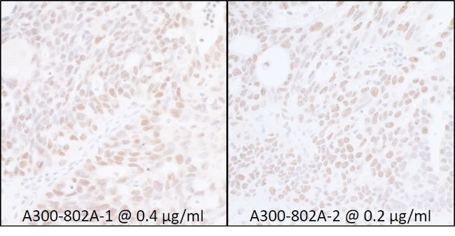 SUPT6H Antibody in Immunohistochemistry (Paraffin) (IHC (P))